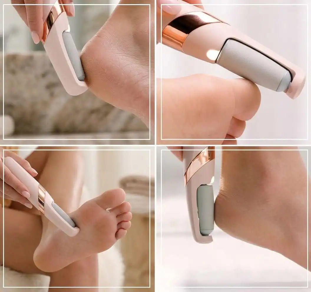 Foot Callus Remover